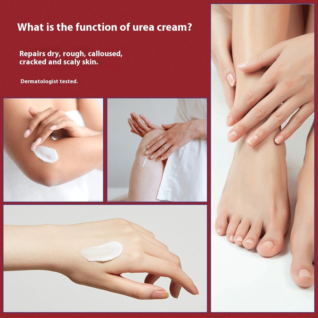 422 Salicylate Urea Cream Anti-chapping Moisturizing Cream