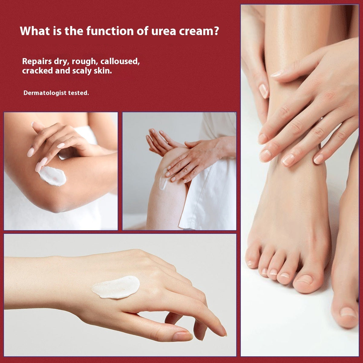 422 Salicylate Urea Cream Anti-chapping Moisturizing Cream