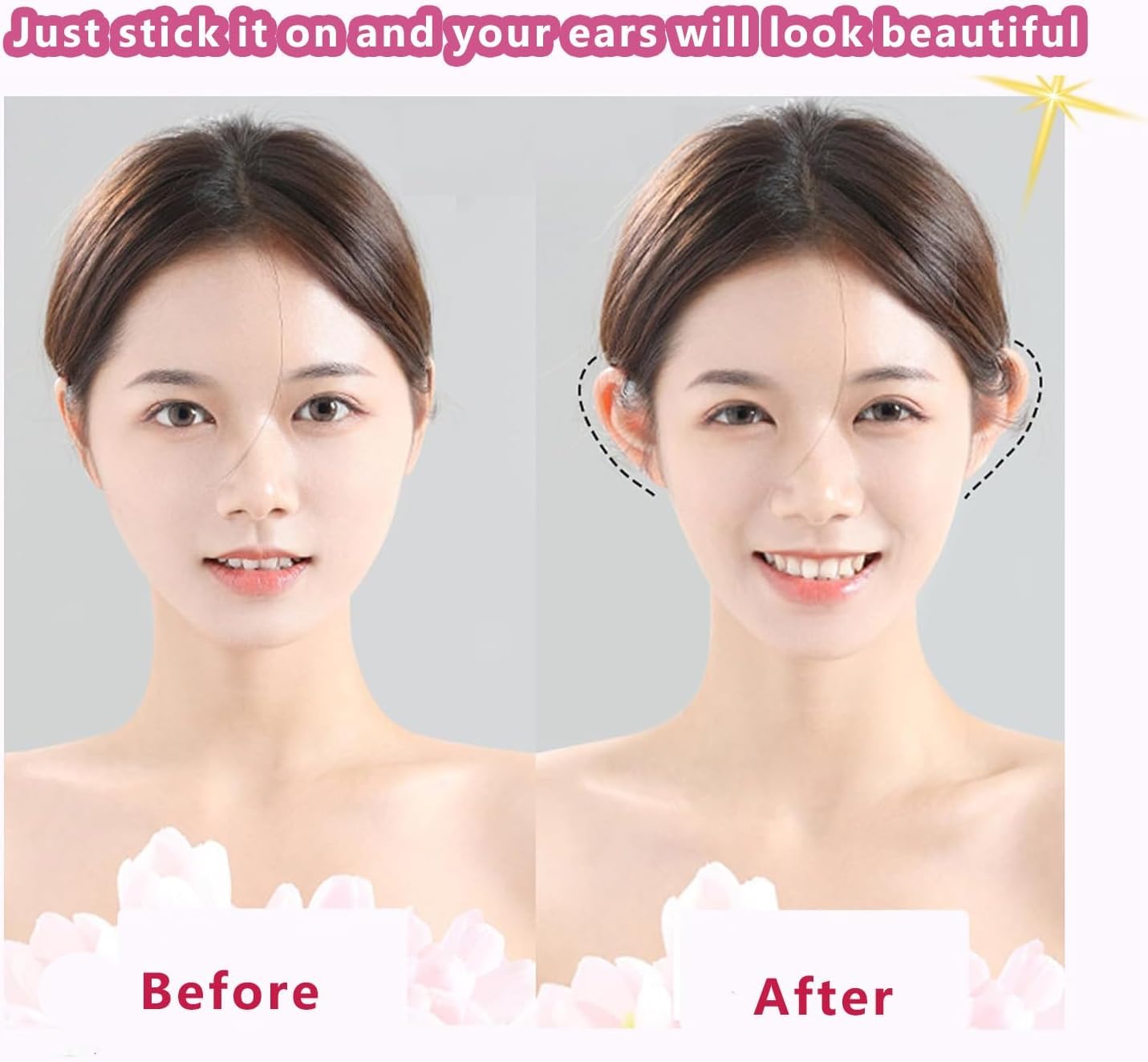 80PCS Ear Correctors Adults, Ear Corrector, Ear Corrector for Prominent Ears Support, 80 PCS Transparent Silicone Ear Stickers, Comfortable and Discreet Solution for Wear