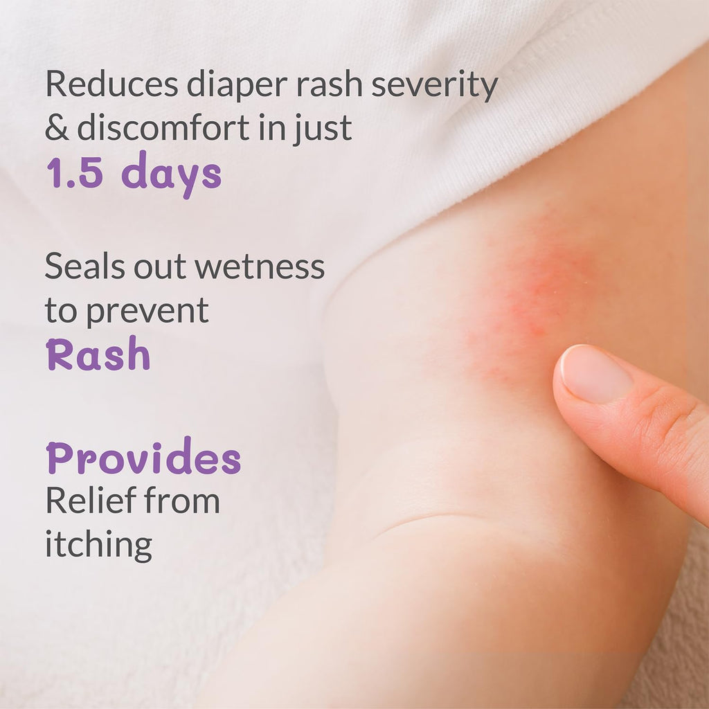 AreoVeda Diaper Rash Cream (50 gm), Suitable for newborns & babies, 15% Zinc Oxide, Prevents & Soothes Rashes from Day 1, Relieves Itchiness & Discomfort