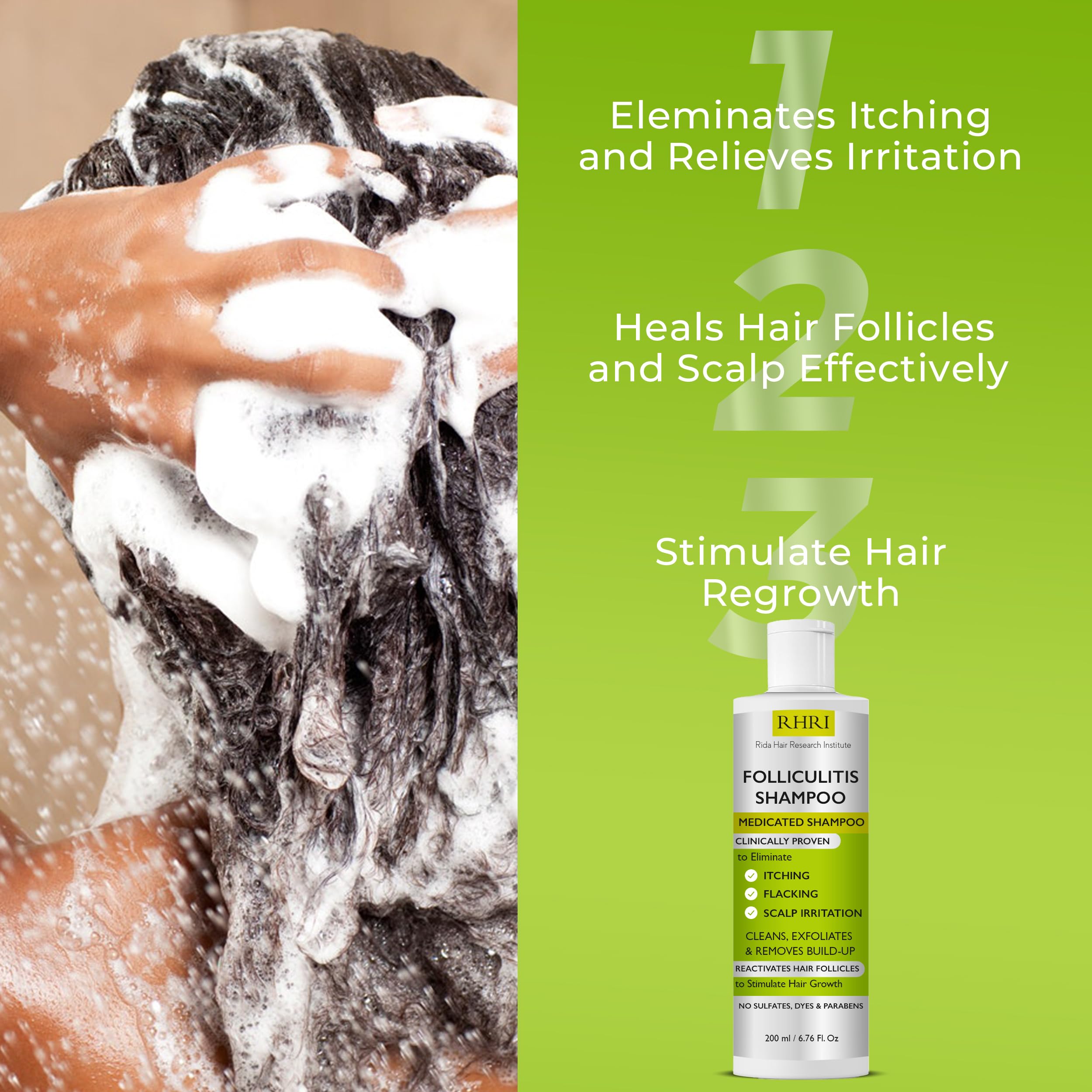 Anti Fungal Shampoo for Folliculitis, Seborrheic Dermatitis, Dandruff, Scalp Psoriasis & Itchy Dry Scalp Relief