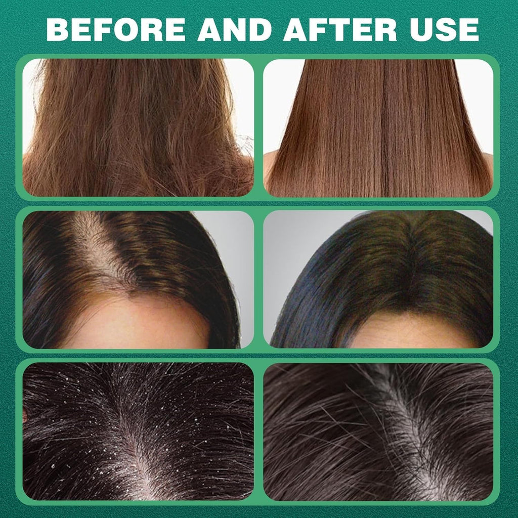 1Pack Nature Triangle Shampoo Bar, Nature Seven Green Soap Shampoo, Natural Usman Grass Hair Shampoo Bar for Women & Men, Solid Shampoo and Conditioner Bars for All Hair Types