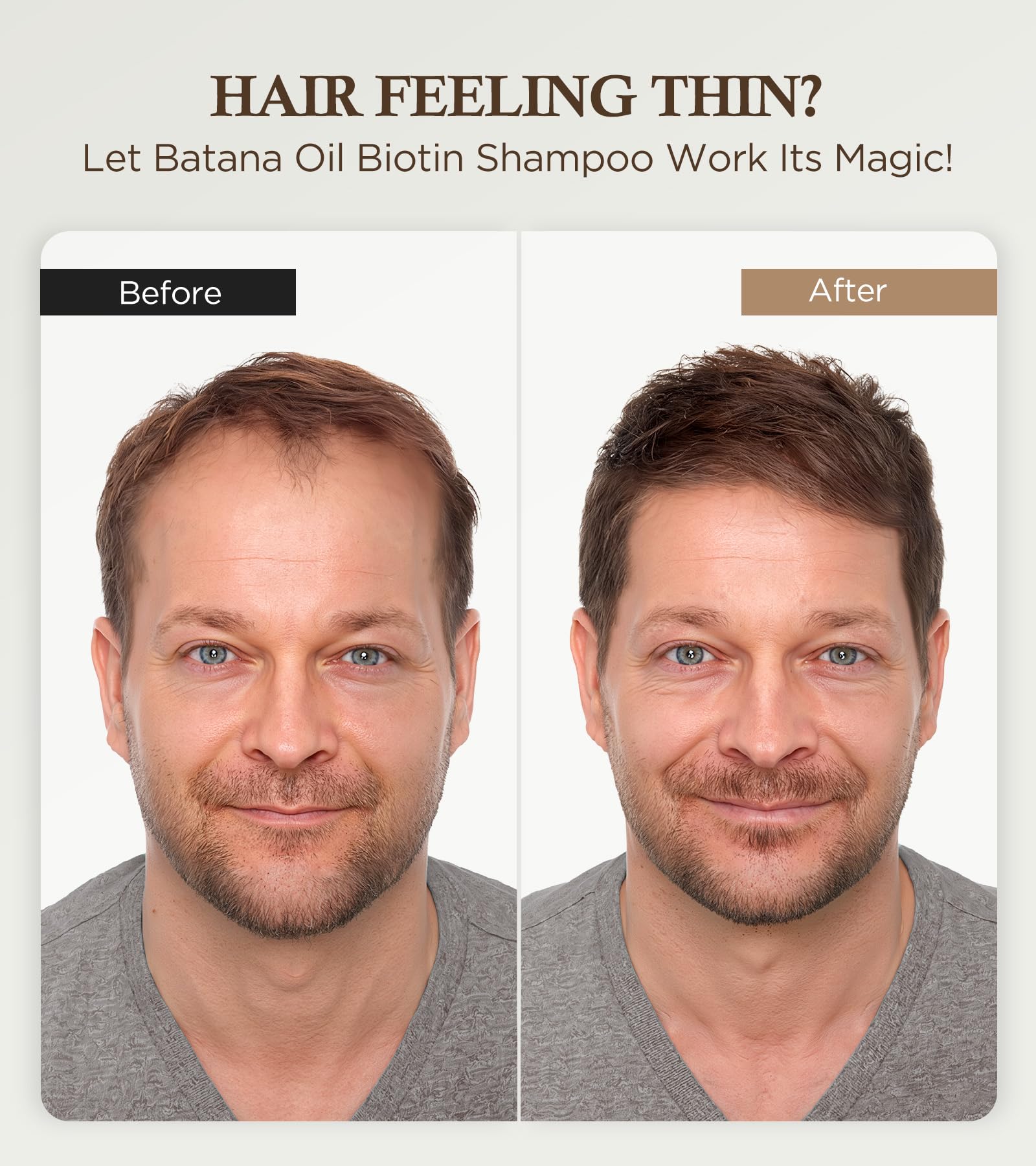 99% Pure Biotin Shampoo for 3X Thicker, Fuller Hair Growth, 80% Less Hair Loss w/Thuja Extract, Batana & Noni Fruit Oil Hair Care for Deep Nourishing,Rosemary Dandruff Treatment for Men Women,11.83oz