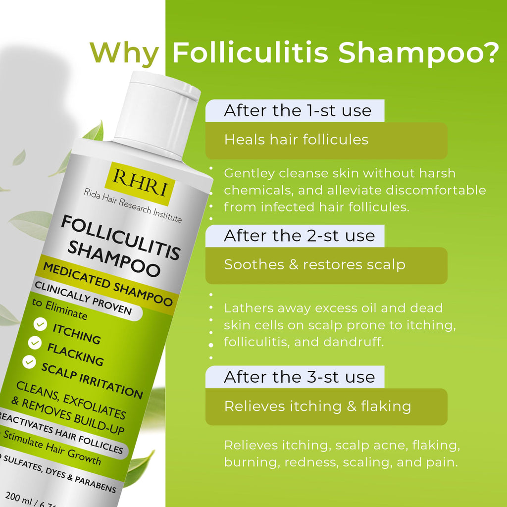 Anti Fungal Shampoo for Folliculitis, Seborrheic Dermatitis, Dandruff, Scalp Psoriasis & Itchy Dry Scalp Relief