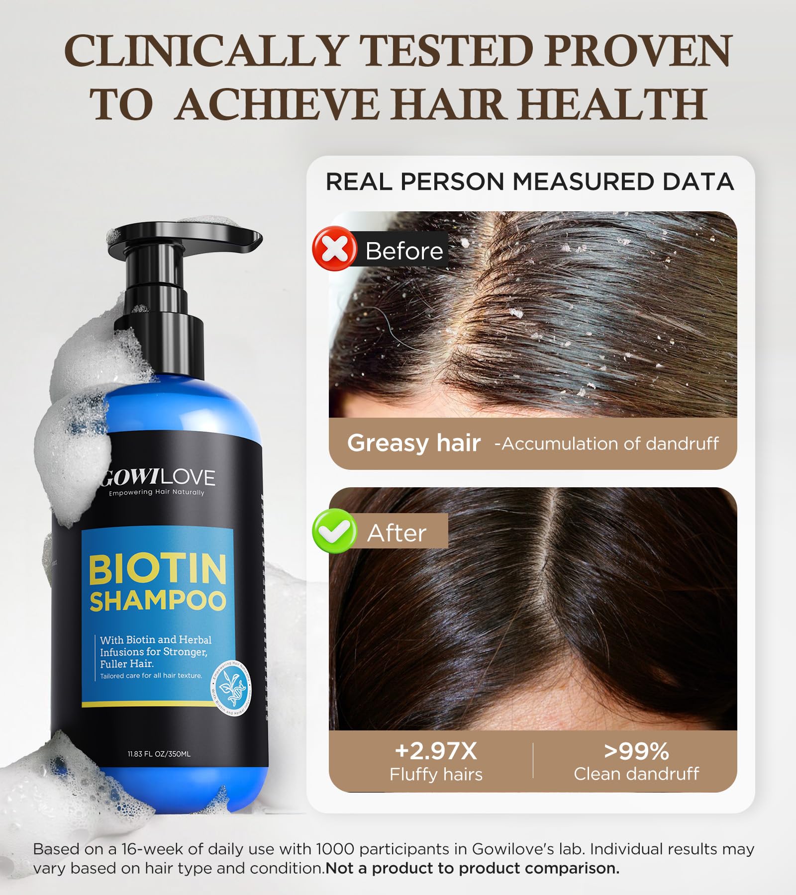 99% Pure Biotin Shampoo for 3X Thicker, Fuller Hair Growth, 80% Less Hair Loss w/Thuja Extract, Batana & Noni Fruit Oil Hair Care for Deep Nourishing,Rosemary Dandruff Treatment for Men Women,11.83oz