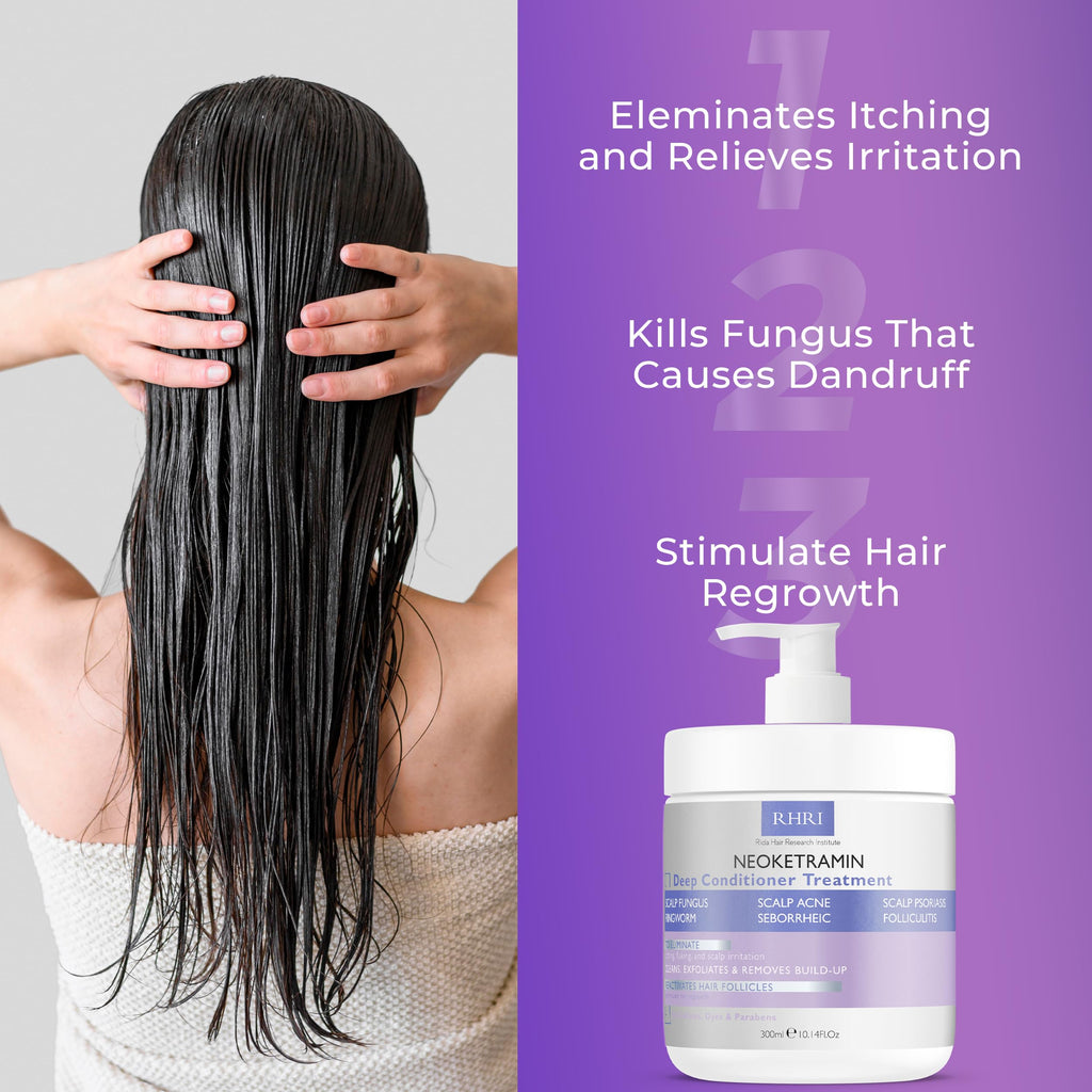 Anti Fungal Deep Conditioner for Men and Women | Scalp Treatment for Psoriasis, Dandruff, Seborrheic Dermatitis | Provides Relief from Folliculitis, Eczema, Itchy, Flaky and Dry Scalp