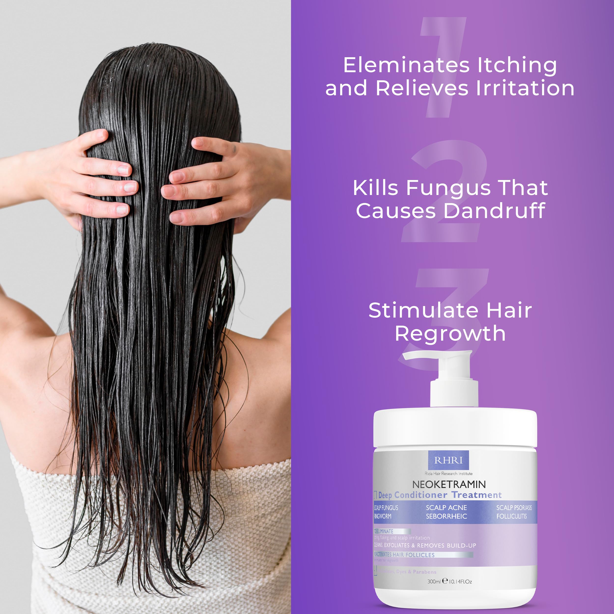 Anti Fungal Deep Conditioner for Men and Women | Scalp Treatment for Psoriasis, Dandruff, Seborrheic Dermatitis | Provides Relief from Folliculitis, Eczema, Itchy, Flaky and Dry Scalp